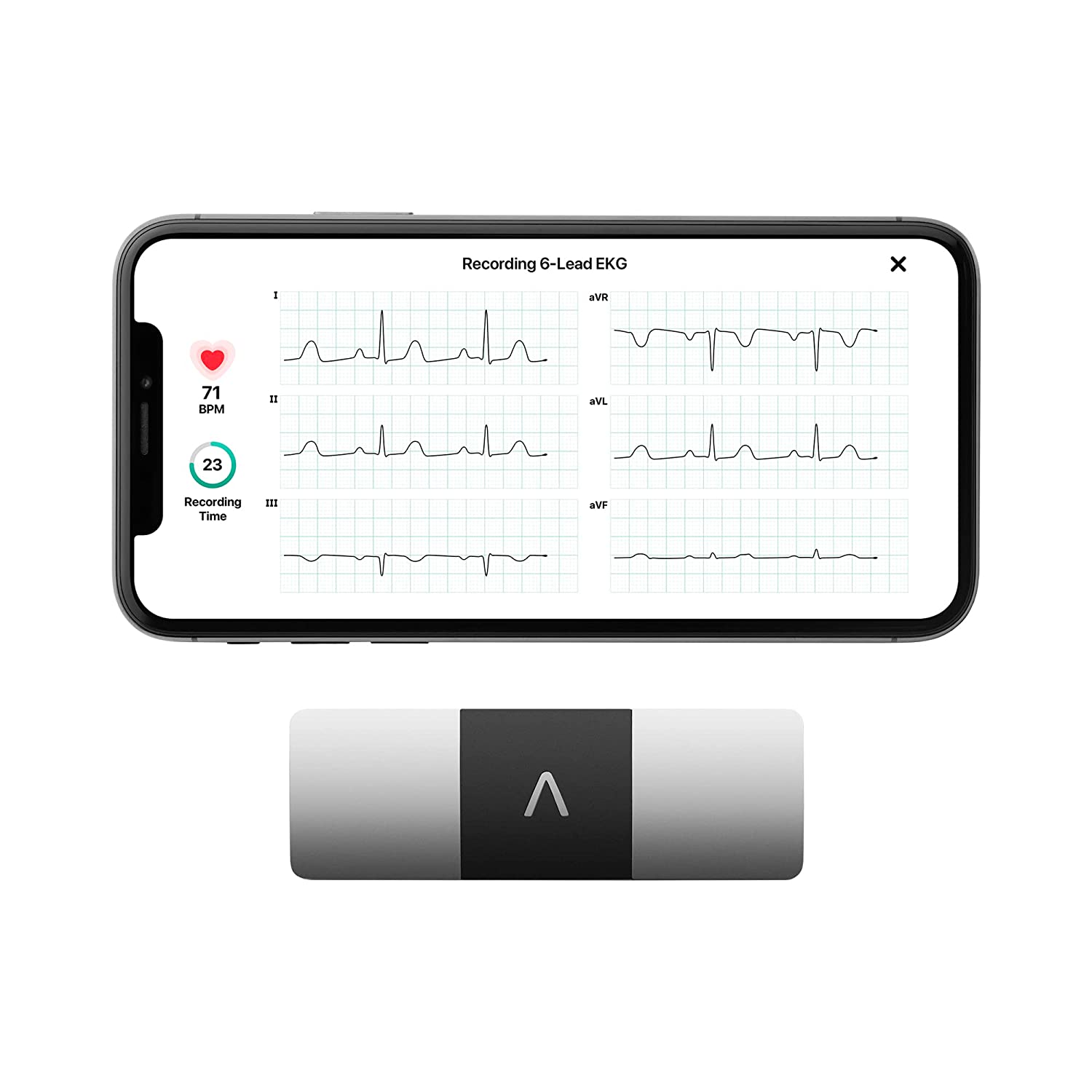 KardiaMobile Six-Lead Portable ECG Device - Fast & Accurate 6 Lead ECG Machine | US FDA Cleared & Clinically Validated Device | Record ECG at Home Safely